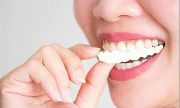 Perfect Smile Carillas Dentales